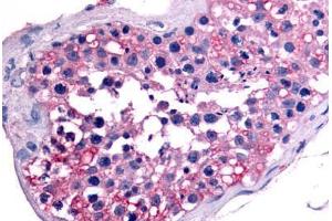 Immunohistochemistry (IHC) image for anti-Nuclear Receptor Subfamily 6, Group A, Member 1 (NR6A1) (Ligand Binding Domain) antibody (ABIN1049149)