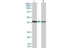 Western Blot analysis of ZNF187 expression in transfected 293T cell line by ZNF187 monoclonal antibody (M01A), clone 1D9. (ZNF187 Antikörper  (AA 1-325))