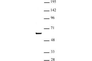 SETD7 / SET7 (pAb) tested by Western blot. (SETD7 Antikörper)