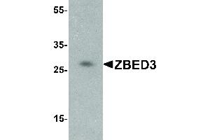Western Blot of ZBED3 Antibody - Western Blot of ZBED3 antibody.