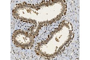 IHC analysis of FOXP1 using anti-FOXP1 antibody (ABIN7602780). (FOXP1 Antikörper  (C-Term))