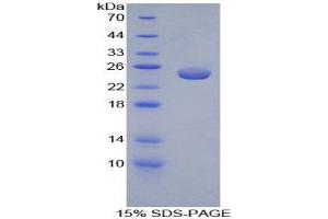 SDS-PAGE (SDS) image for Peroxiredoxin 5 (PRDX5) (AA 1-210) protein (His tag) (ABIN1080502) (Peroxiredoxin 5 Protein (PRDX5) (AA 1-210) (His tag))