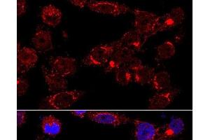 Immunofluorescence analysis of HeLa cells using GM130 Polyclonal Antibody at dilution of 1:400 (60x lens). (Golgin A2 (GOLGA2) Antikörper)