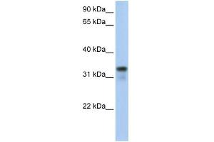 WB Suggested Anti-GLYATL2 Antibody Titration:  0. (GLYATL2 Antikörper  (Middle Region))