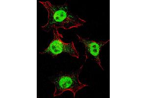 Fluorescent confocal image of HeLa cells stained with ITGA6 (isoform 2 ) antibody. (ITGA6 Antikörper  (Isoform 2))