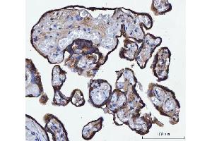 IHC analysis of TMPRSS13 using anti-TMPRSS13 antibody (ABIN7599797). (TMPRSS13 Antikörper  (AA 118-572))