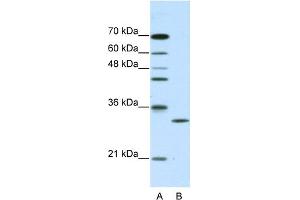 CLIC1 antibody - C-terminal region  validated by WB using purified recombinant CLIC1 protein and transfected lysate (CLIC1 Antikörper  (C-Term))