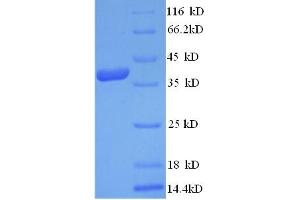 SDS-PAGE (SDS) image for LY6/PLAUR Domain Containing 6 (LYPD6) (AA 23-171) protein (GST tag) (ABIN5711469) (LYPD6 Protein (AA 23-171) (GST tag))