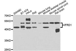 Western blot analysis of extracts of various cell lines, using IFRD1 antibody. (IFRD1 Antikörper)