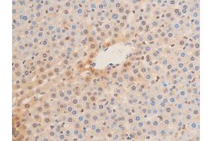 Immunohistochemistry (IHC) image for anti-Lamin A/C (LMNA) (pSer392) antibody (ABIN6256311)