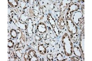 Immunohistochemical staining of paraffin-embedded liver tissue using anti-ERCC1 mouse monoclonal antibody. (ERCC1 Antikörper)