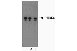 Western blot analysis of AIM-1 on a Jurkat cell lysate (Human T-cell leukemia, ATCC TIB-152).