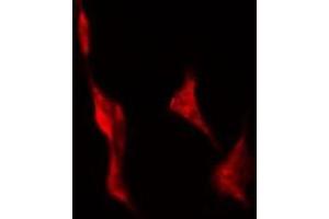 ABIN6278640 staining Hela by IF/ICC. (TAS2R43 Antikörper)