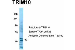 Human Jurkat; Host: Rabbit. (TRIM10 Antikörper  (C-Term))
