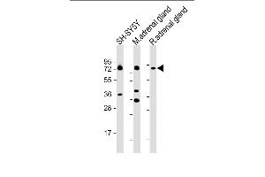 All lanes : Anti-DBH Antibody (N-term P42) at 1:2000 dilution Lane 1: SH-SY5Y whole cell lysate Lane 2: mouse adrenal gland lysate Lane 3: rat adrenal gland lysate Lysates/proteins at 20 μg per lane. (DBH Antikörper  (N-Term))