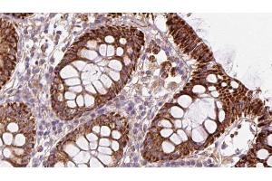 ABIN6272882 at 1/100 staining Mouse colon tissue by IHC-P. (CISD1 Antikörper  (Internal Region))
