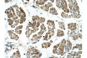 RHOT1 antibody was used for immunohistochemistry at a concentration of 4-8 ug/ml to stain Skeletal muscle cells (arrows) in Human Muscle. (RHOT1 Antikörper  (N-Term))