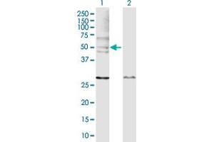 Western Blot analysis of WASL expression in transfected 293T cell line by WASL MaxPab polyclonal antibody. (Neural Wiskott-Aldrich syndrome protein (WASL) (AA 1-505) Antikörper)