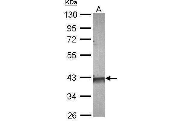 FDPS Antikörper