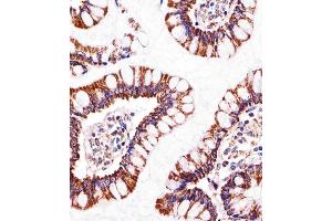 Immunohistochemistry (Paraffin-embedded Sections) (IHC (p)) image for anti-ATP Synthase, H+ Transporting, Mitochondrial F1 Complex, beta Polypeptide (ATP5B) (AA 135-163) antibody (ABIN650786)