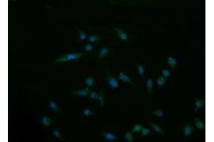 Image no. 1 for anti-Cancer/testis Antigen 1B (CTAG1B) antibody (ABIN1499903) (CTAG1B Antikörper)