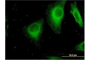 Immunofluorescence of monoclonal antibody to STAB1 on HeLa cell. (Stabilin 1 Antikörper  (AA 1804-1902))