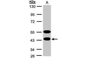 WB Image Sample(30 ug whole cell lysate) A:MOLT4 , 10% SDS PAGE antibody diluted at 1:1000