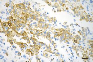 anti-Chloride Intracellular Channel 4 (CLIC4) antibody