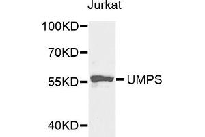Western blot analysis of extracts of Jurkat cells, using UMPS antibody (ABIN5973202) at 1/1000 dilution.