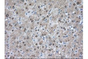 Immunohistochemical staining of paraffin-embedded Human prostate tissue using anti-PDE4A mouse monoclonal antibody. (PDE4A Antikörper)