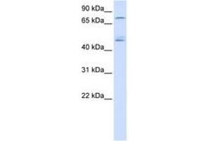 Image no. 1 for anti-DEAD (Asp-Glu-Ala-Asp) Box Polypeptide 1 (DDX1) (AA 36-85) antibody (ABIN6740488) (DDX1 Antikörper  (AA 36-85))