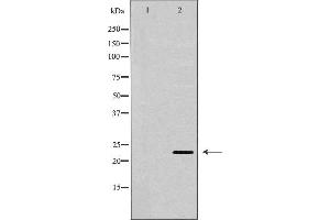 Western blot analysis of extracts of MCF7, using BAK1 antibody. (BAK1 Antikörper  (N-Term))