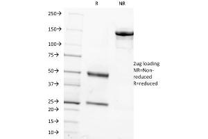 SDS-PAGE Analysis Purified FSH beta Mouse Monoclonal Antibody (FSHb/1062). (FSHB Antikörper)