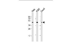 Lane 1: HeLa Cell lysates, Lane 2: K562 Cell lysates, Lane 3: Daudi Cell lysates, probed with PLIN3 (1651CT157. (PLIN3 Antikörper)