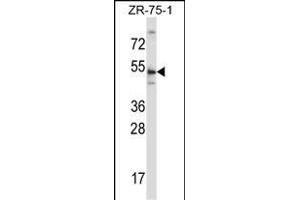TERF2 Antibody (Center) (ABIN657781 and ABIN2846755) western blot analysis in ZR-75-1 cell line lysates (35 μg/lane). (TRF2 Antikörper  (AA 308-337))