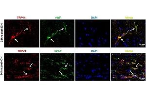 Expression of TRPV4 in rat perihematomal area following ICH.