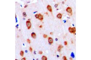 Immunohistochemical analysis of ALK1 staining in human brain formalin fixed paraffin embedded tissue section.