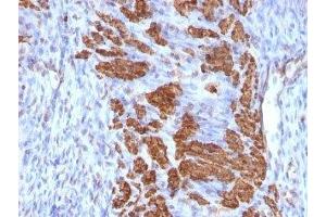 Formalin-fixed, paraffin-embedded rat uterus stained with Calponin antibody (CNN1/832 + CALP). (Calponin Antikörper)