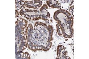 Immunohistochemical staining of human colon with EFR3A polyclonal antibody  shows srrong cytoplasmic positivity with granular pattern in glandular cells at 1:20-1:50 dilution. (EFR3A Antikörper)