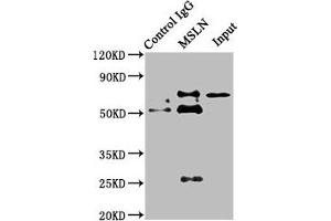 Immunoprecipitating MSLN in HepG2 whole cell lysate Lane 1: Rabbit control IgG instead of ABIN7159428 in HepG2 whole cell lysate. (Mesothelin Antikörper  (AA 37-598))