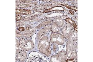 Immunohistochemical staining of human kidney with TSSC4 polyclonal antibody  shows strong cytoplasmic and moderate nuclear positivity in subsets of tubules at 1:1000-1:2500 dilution.
