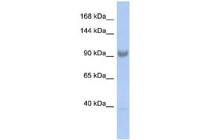 Western Blotting (WB) image for anti-Squamous Cell Carcinoma Antigen Recognized By T Cells 3 (SART3) (Middle Region) antibody (ABIN2775728)