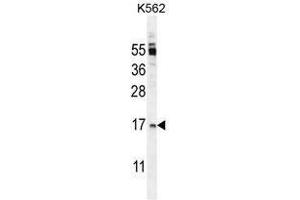 TNFSF4 Antibody (Center) western blot analysis in K562 cell line lysates (35 µg/lane). (TNFSF4 Antikörper  (Middle Region))