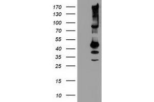 Western Blotting (WB) image for anti-serpin Peptidase Inhibitor, Clade B (Ovalbumin), Member 13 (SERPINB13) antibody (ABIN1500881) (SERPINB13 Antikörper)