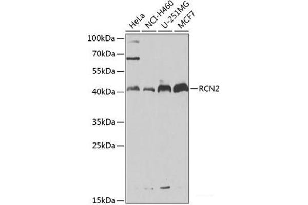RCN2 antibody