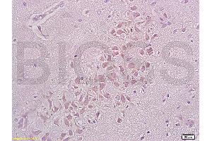 Formalin-fixed and paraffin embedded rat brain tissue labeled with Anti-Integrin beta 1/CD29 Polyclonal Antibody (ABIN669216), Unconjugated at 1:200, followed by conjugation to the secondary antibody and DAB staining (ITGB1 Antikörper  (AA 25-100))