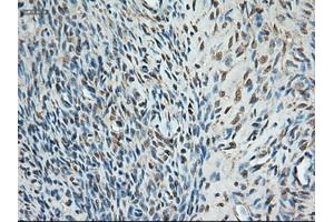 Immunohistochemical staining of paraffin-embedded colon using anti-Trim33 (ABIN2452535) mouse monoclonal antibody. (TRIM33 Antikörper  (AA 887-1046))