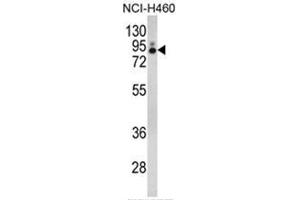 Western blot analysis of PLA2G4A Antibody (Center) in NCI-H460 cell line lysates (35ug/lane). (PLA2G4A Antikörper  (Middle Region))