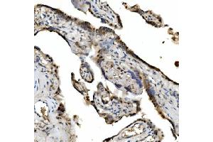 IHC analysis of VPRBP/DCAF1 using anti-VPRBP/DCAF1 antibody (ABIN7599063). (DDB1 and CUL4-Associated Factor 1 (DCAF1) (AA 1-195) Antikörper)