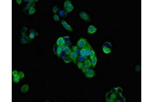 Immunofluorescent analysis of PC-3 cells using ABIN7158932 at dilution of 1:100 and Alexa Fluor 488-congugated AffiniPure Goat Anti-Rabbit IgG(H+L) (PRNP Antikörper  (AA 23-64))